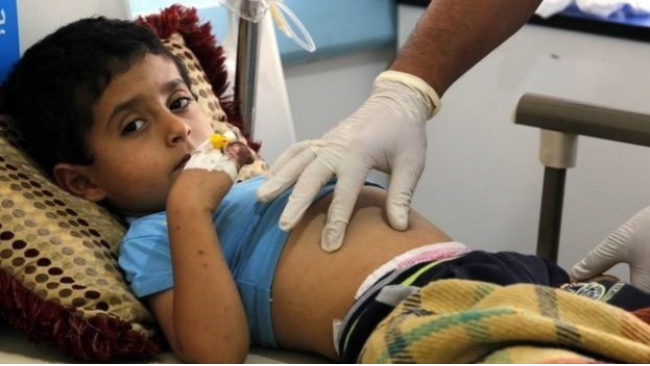 شمار مبتلایان به وبا در یمن به بیش از ۳۰۰ هزار نفر رسیده است